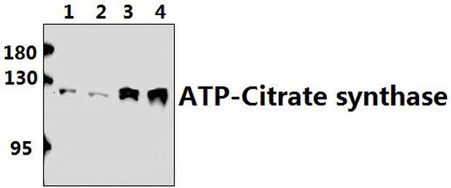 ATP Citrate Lyase Antibody in Western Blot (WB)