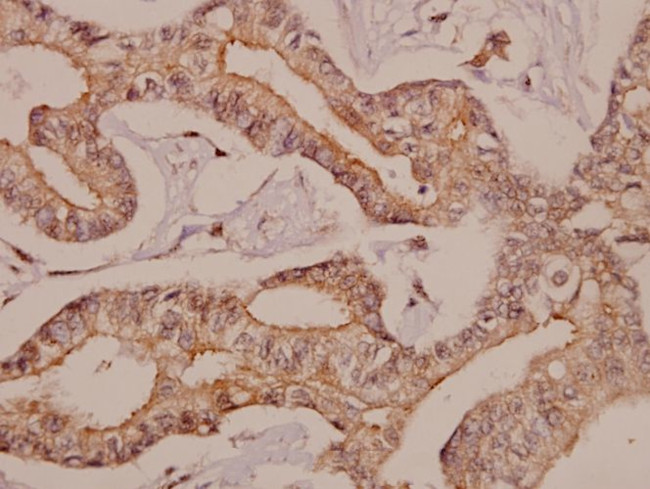 beta-2 Adrenergic Receptor Antibody in Immunohistochemistry (Paraffin) (IHC (P))