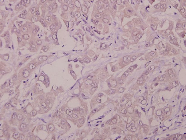 IFNAR1 Antibody in Immunohistochemistry (Paraffin) (IHC (P))