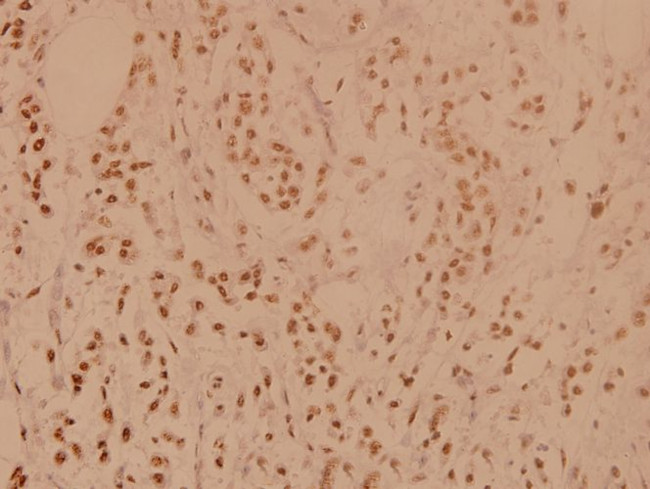 PP1 alpha Antibody in Immunohistochemistry (Paraffin) (IHC (P))