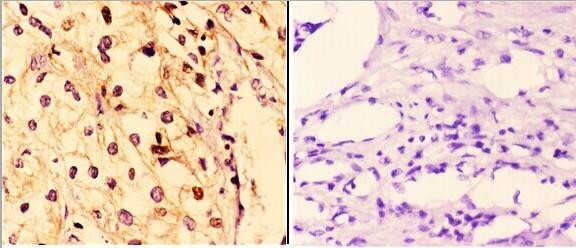 14-3-3 zeta Antibody in Immunohistochemistry (Paraffin) (IHC (P))