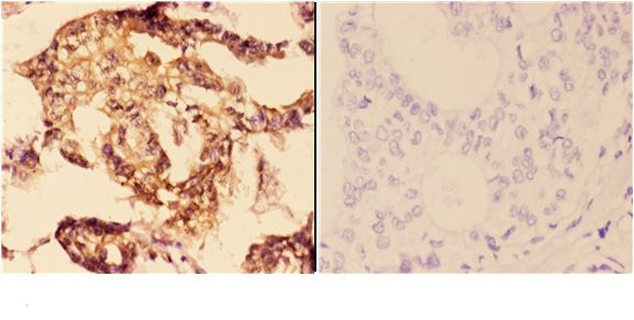 14-3-3 zeta Antibody in Immunohistochemistry (Paraffin) (IHC (P))