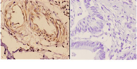 14-3-3 zeta Antibody in Immunohistochemistry (Paraffin) (IHC (P))