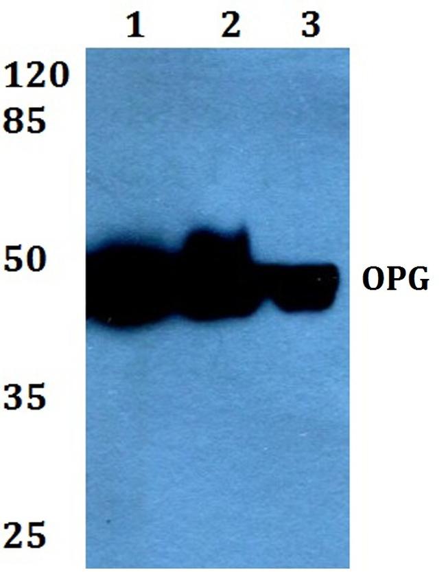 TNFRSF11B Antibody in Western Blot (WB)