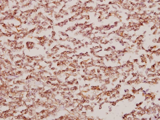 BCKDK Antibody in Immunohistochemistry (Paraffin) (IHC (P))