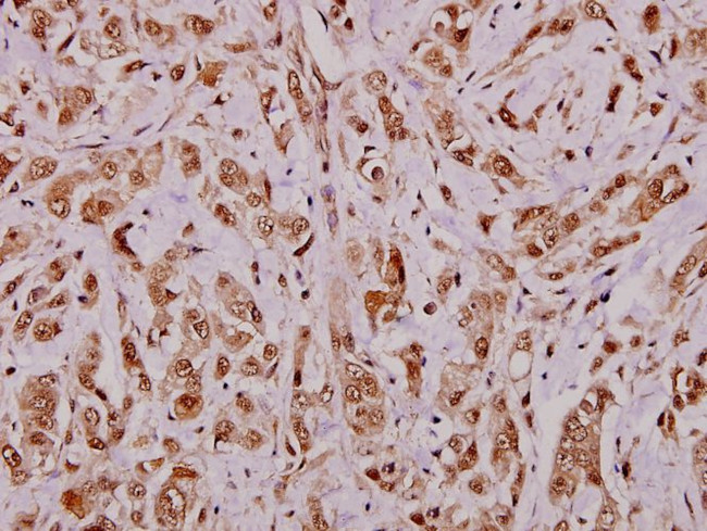 APRIL Antibody in Immunohistochemistry (Paraffin) (IHC (P))