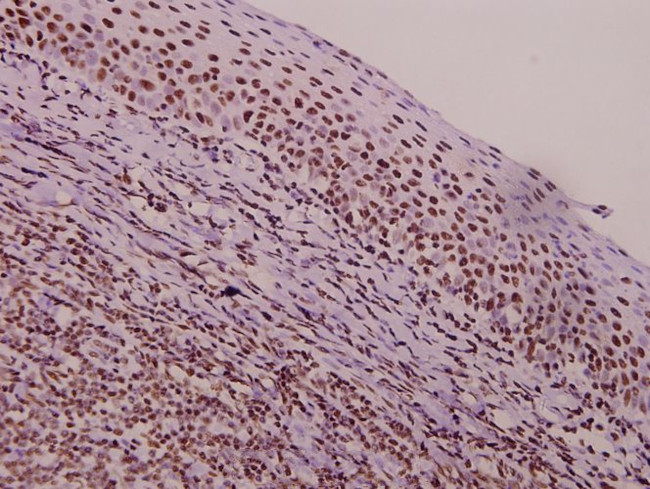 TROP2 Antibody in Immunohistochemistry (Paraffin) (IHC (P))