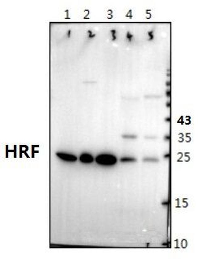 TPT1 Antibody in Western Blot (WB)