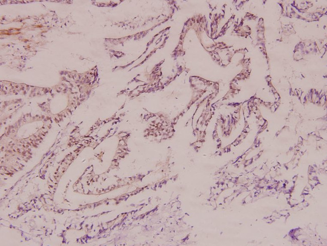 HK1 Antibody in Immunohistochemistry (Paraffin) (IHC (P))