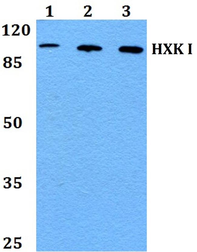 HK1 Antibody in Western Blot (WB)