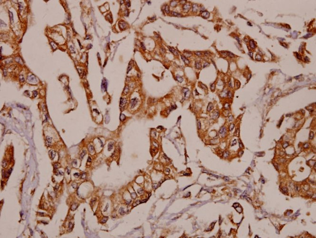 TNFR2 Antibody in Immunohistochemistry (Paraffin) (IHC (P))