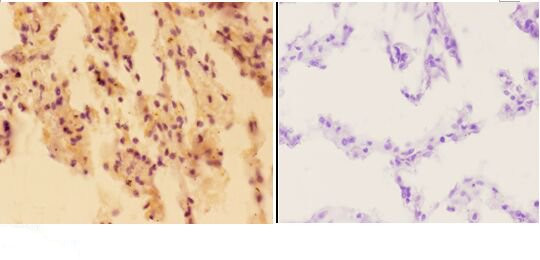 APE1 Antibody in Immunohistochemistry (Paraffin) (IHC (P))