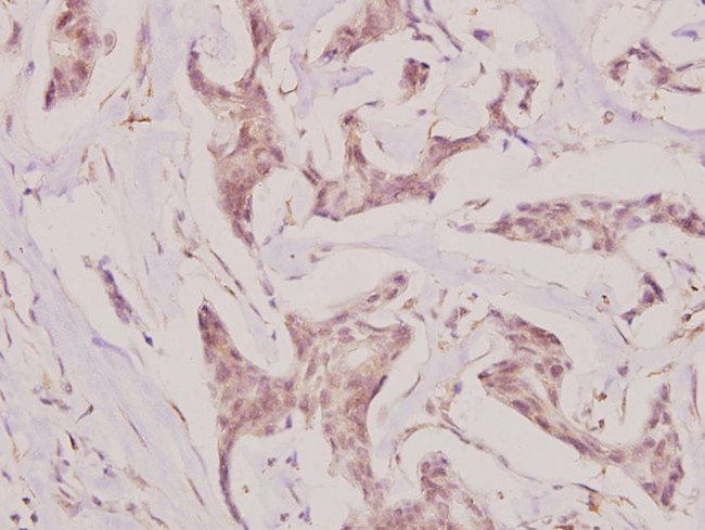 CMPK1 Antibody in Immunohistochemistry (Paraffin) (IHC (P))