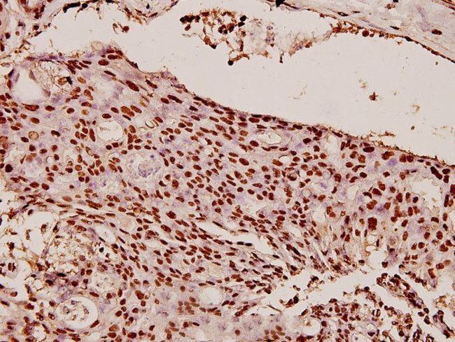 HP1 alpha Antibody in Immunohistochemistry (Paraffin) (IHC (P))