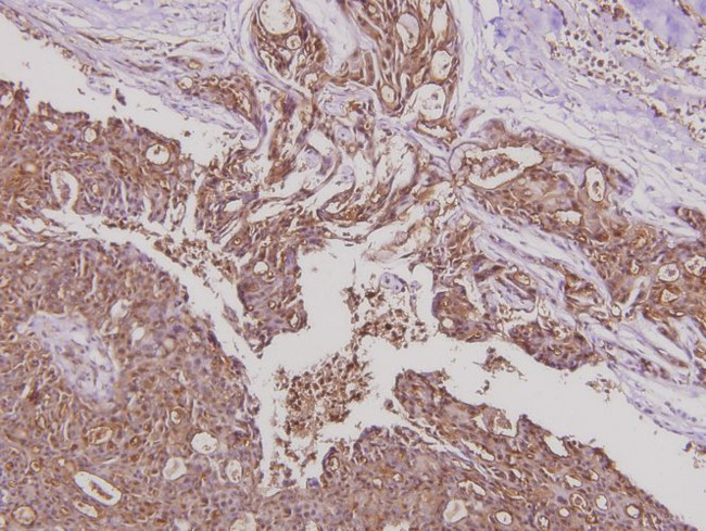 YAP1 Antibody in Immunohistochemistry (Paraffin) (IHC (P))