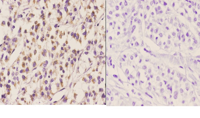 ELL Antibody in Immunohistochemistry (Paraffin) (IHC (P))