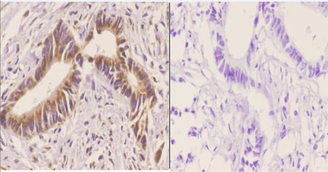 14-3-3 beta Antibody in Immunohistochemistry (Paraffin) (IHC (P))