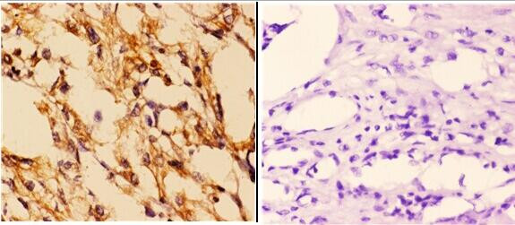 14-3-3 epsilon Antibody in Immunohistochemistry (Paraffin) (IHC (P))