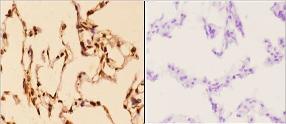 14-3-3 epsilon Antibody in Immunohistochemistry (Paraffin) (IHC (P))