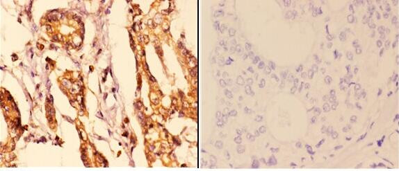 14-3-3 epsilon Antibody in Immunohistochemistry (Paraffin) (IHC (P))