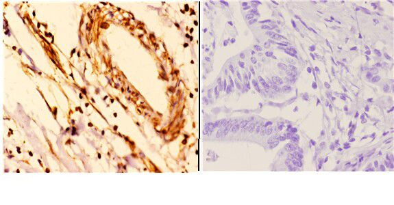 14-3-3 epsilon Antibody in Immunohistochemistry (Paraffin) (IHC (P))