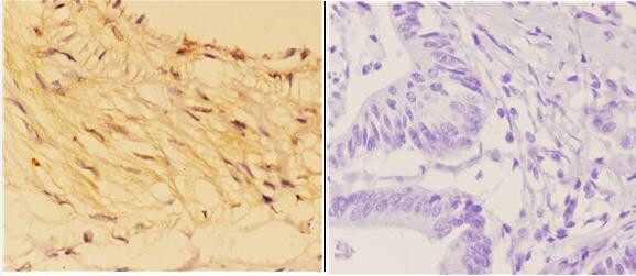 14-3-3 sigma Antibody in Immunohistochemistry (Paraffin) (IHC (P))