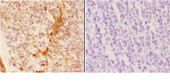 14-3-3 sigma Antibody in Immunohistochemistry (Paraffin) (IHC (P))