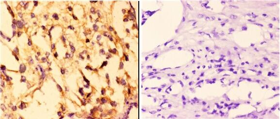 14-3-3 sigma Antibody in Immunohistochemistry (Paraffin) (IHC (P))