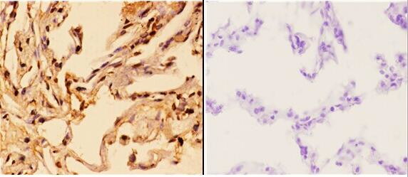 14-3-3 theta Antibody in Immunohistochemistry (Paraffin) (IHC (P))