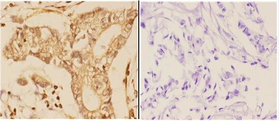 14-3-3 theta Antibody in Immunohistochemistry (Paraffin) (IHC (P))