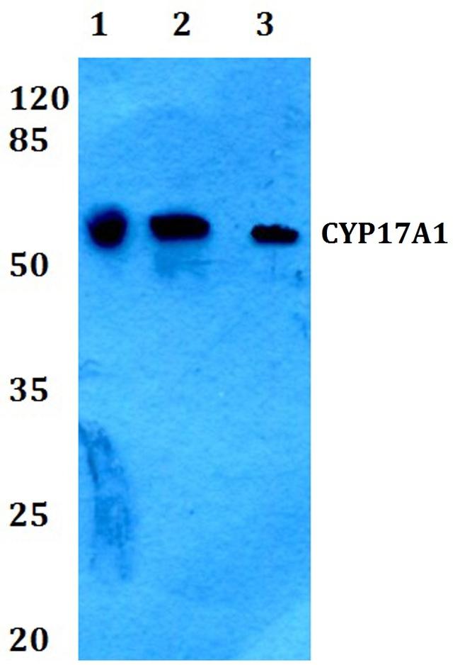 CYP17A1 Antibody in Western Blot (WB)