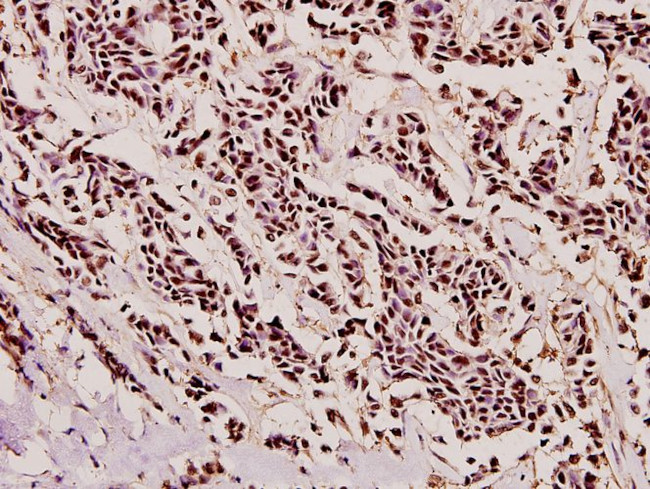 PYCARD Antibody in Immunohistochemistry (Paraffin) (IHC (P))