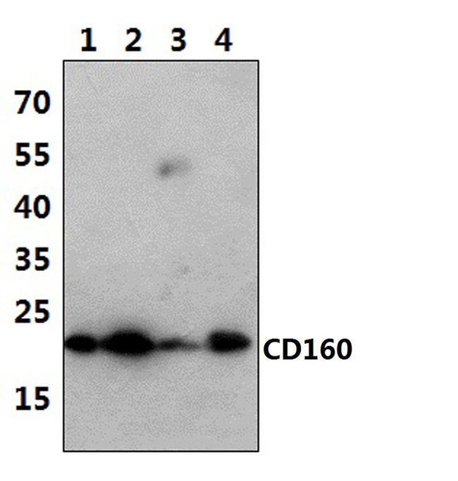 CD160 Antibody in Western Blot (WB)