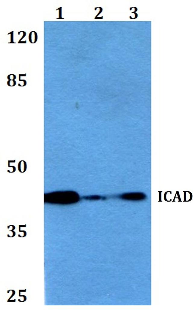 ICAD Antibody in Western Blot (WB)