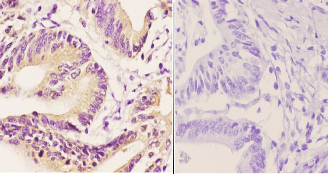 TBP Antibody in Immunohistochemistry (Paraffin) (IHC (P))