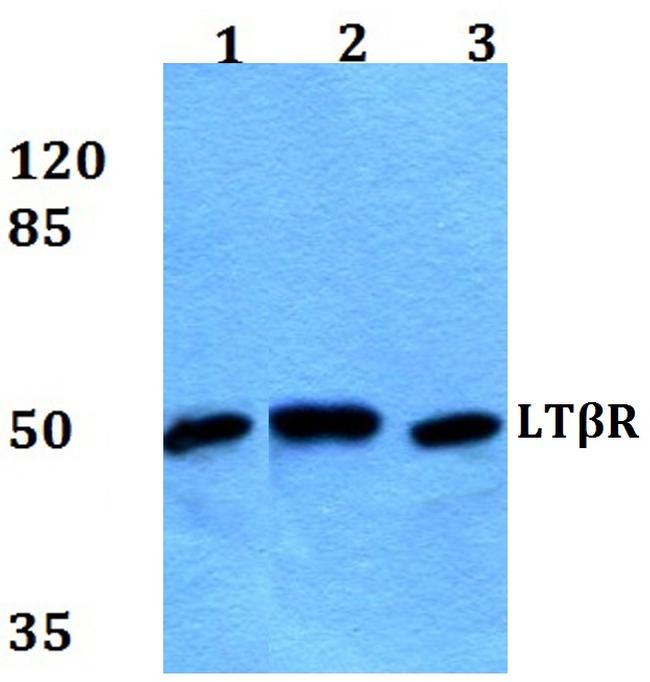 LTBR Antibody in Western Blot (WB)