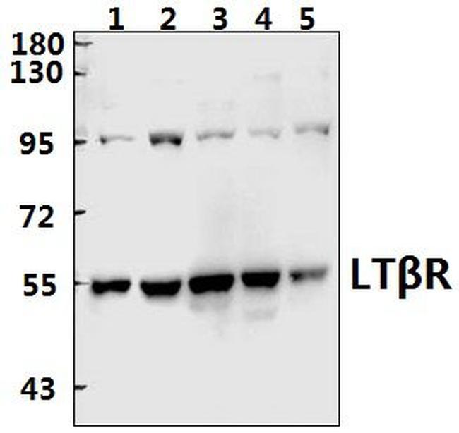 LTBR Antibody in Western Blot (WB)