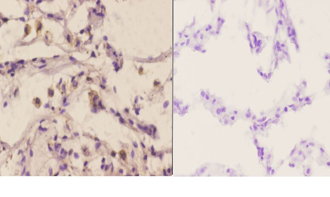 MAP2K4 Antibody in Immunohistochemistry (Paraffin) (IHC (P))