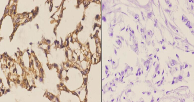 MAP2K4 Antibody in Immunohistochemistry (Paraffin) (IHC (P))