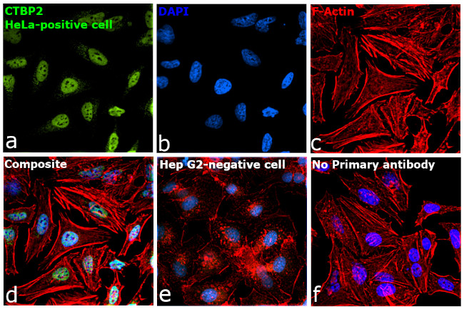 CtBP2 Antibody in Immunocytochemistry (ICC/IF)