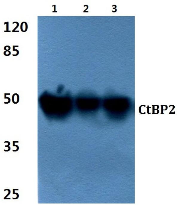 CtBP2 Antibody in Western Blot (WB)