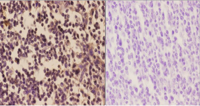 PFKP Antibody in Immunohistochemistry (Paraffin) (IHC (P))