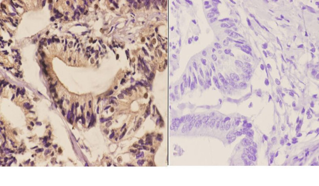 PFKP Antibody in Immunohistochemistry (Paraffin) (IHC (P))