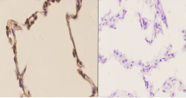 PFKP Antibody in Immunohistochemistry (Paraffin) (IHC (P))