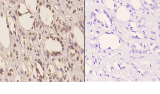 TSG101 Antibody in Immunohistochemistry (Paraffin) (IHC (P))