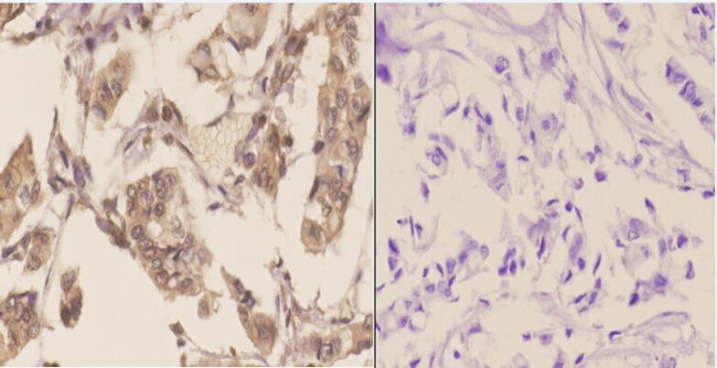 TSG101 Antibody in Immunohistochemistry (Paraffin) (IHC (P))