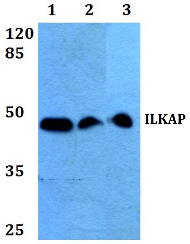 ILKAP Antibody in Western Blot (WB)