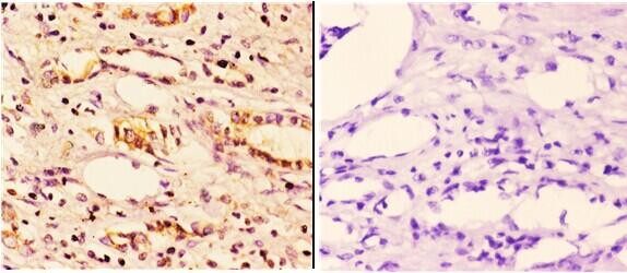 14-3-3 zeta Antibody in Immunohistochemistry (Paraffin) (IHC (P))