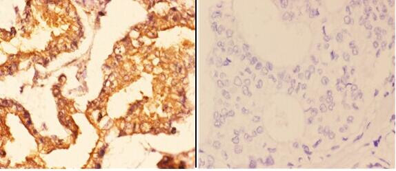 14-3-3 zeta Antibody in Immunohistochemistry (Paraffin) (IHC (P))