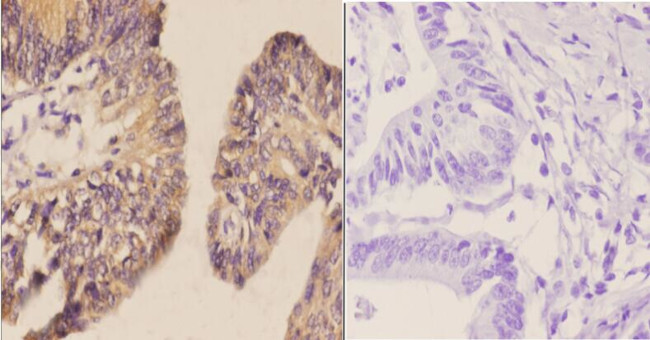 CDH17 Antibody in Immunohistochemistry (Paraffin) (IHC (P))